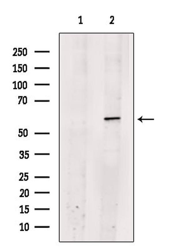 PAF1 Antibody in Western Blot (WB)