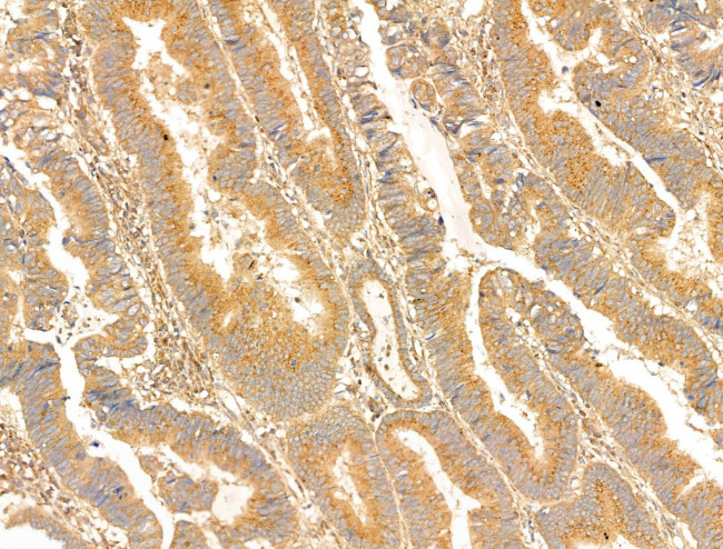 PAG1 Antibody in Immunohistochemistry (Paraffin) (IHC (P))