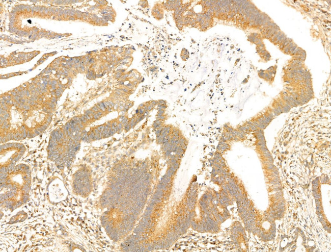 PAG1 Antibody in Immunohistochemistry (Paraffin) (IHC (P))