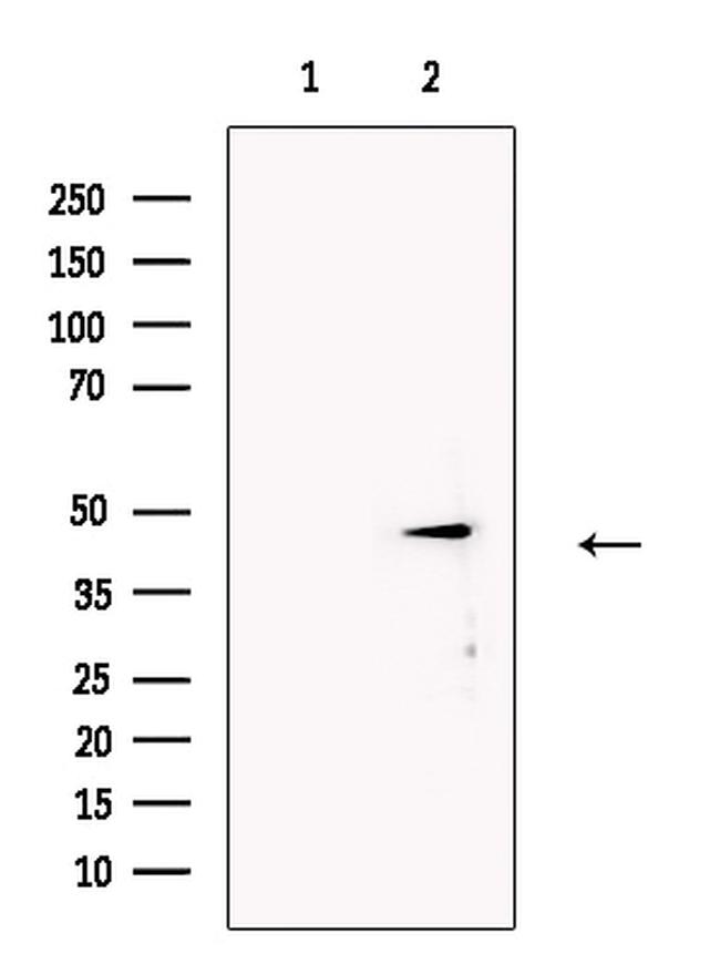 PAG1 Antibody in Western Blot (WB)