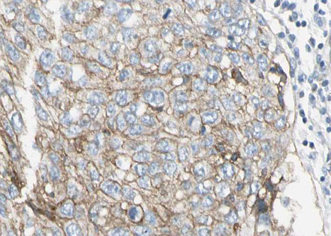 PAI1 Antibody in Immunohistochemistry (Paraffin) (IHC (P))