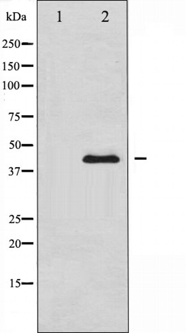 PAI1 Antibody in Western Blot (WB)
