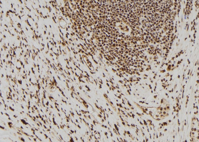 PAK5 Antibody in Immunohistochemistry (Paraffin) (IHC (P))