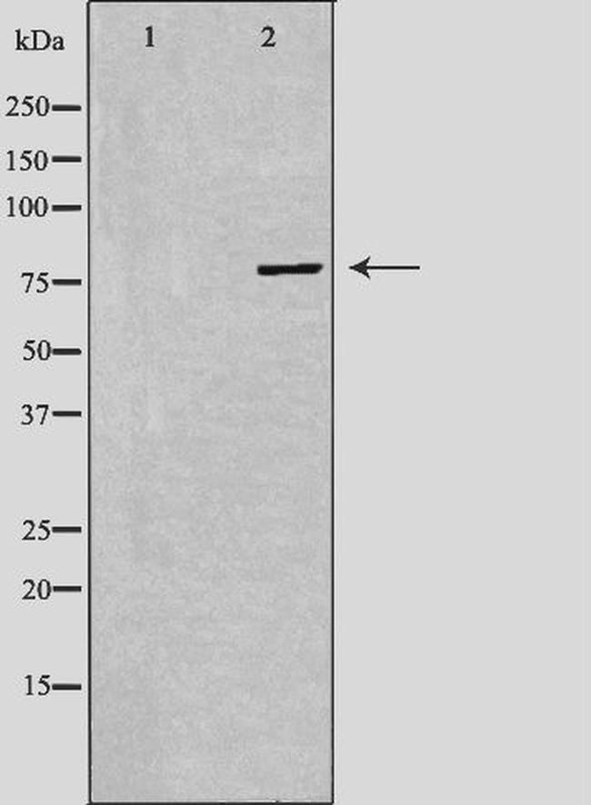 PAK5 Antibody in Western Blot (WB)