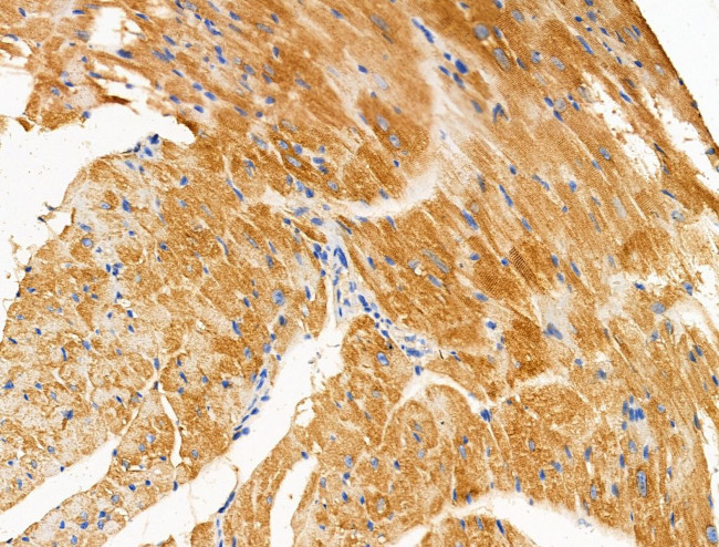 PAPPA2 Antibody in Immunohistochemistry (Paraffin) (IHC (P))