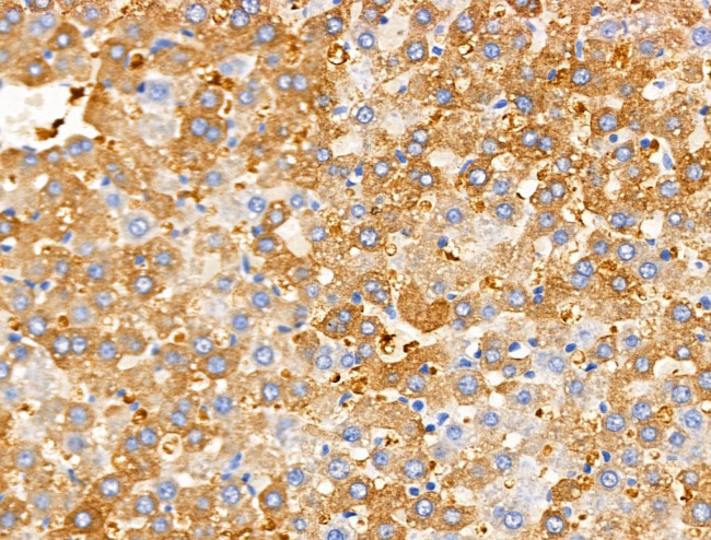 PAPPA2 Antibody in Immunohistochemistry (Paraffin) (IHC (P))