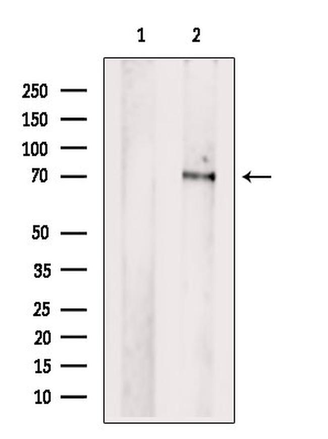 PCK2 Antibody in Western Blot (WB)