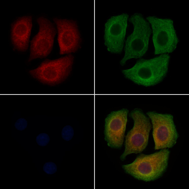 PCSK9 Antibody in Immunocytochemistry (ICC/IF)