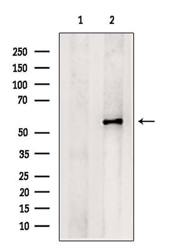 PCSK9 Antibody in Western Blot (WB)