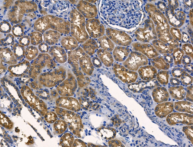 PDE11A Antibody in Immunohistochemistry (Paraffin) (IHC (P))