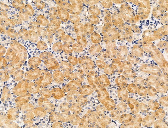 PDE11A Antibody in Immunohistochemistry (Paraffin) (IHC (P))