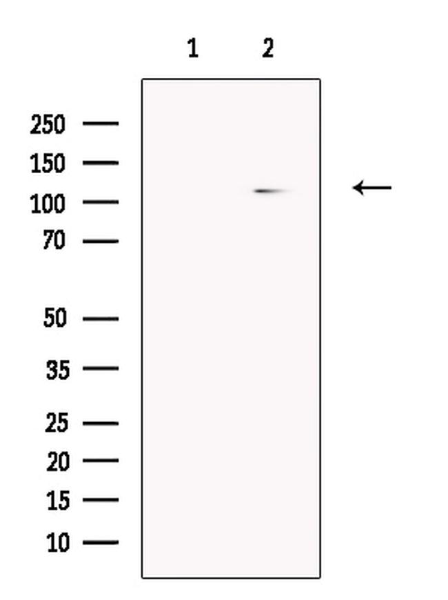 PDE11A Antibody in Western Blot (WB)