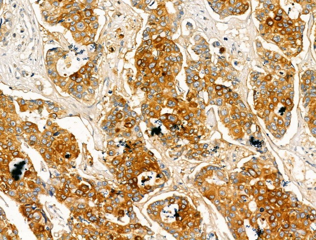 Pericentrin Antibody in Immunohistochemistry (Paraffin) (IHC (P))