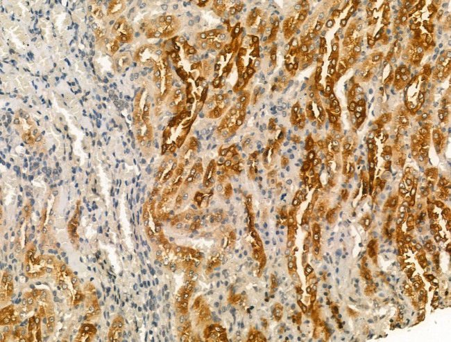 Pericentrin Antibody in Immunohistochemistry (Paraffin) (IHC (P))