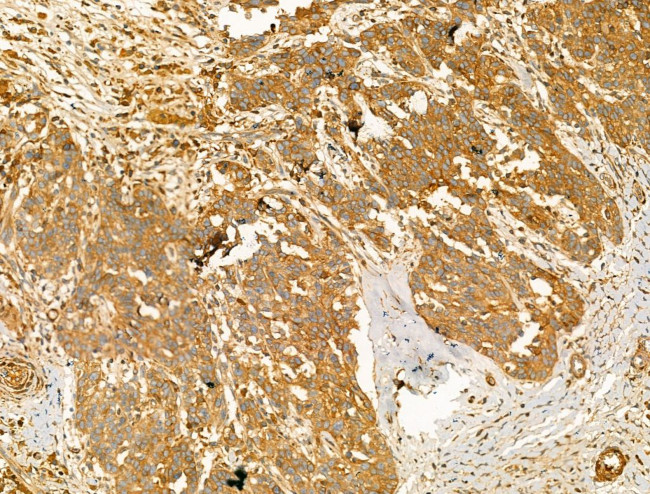 Pericentrin Antibody in Immunohistochemistry (Paraffin) (IHC (P))