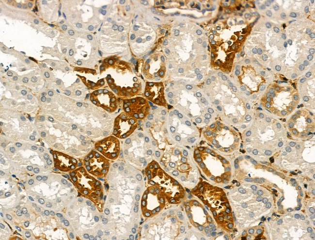 Pericentrin Antibody in Immunohistochemistry (Paraffin) (IHC (P))