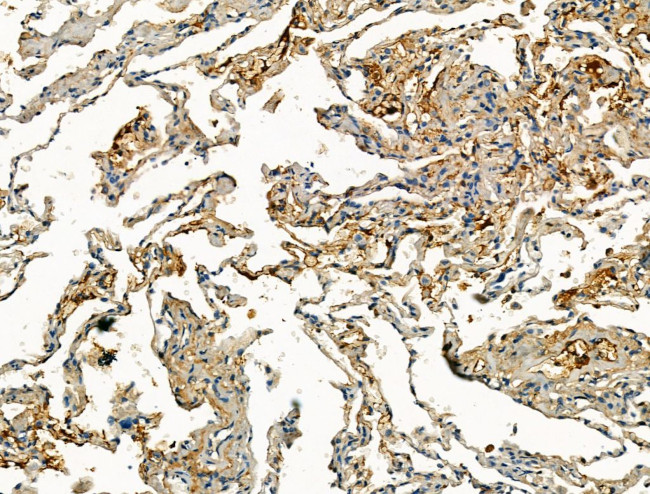 Pericentrin Antibody in Immunohistochemistry (Paraffin) (IHC (P))