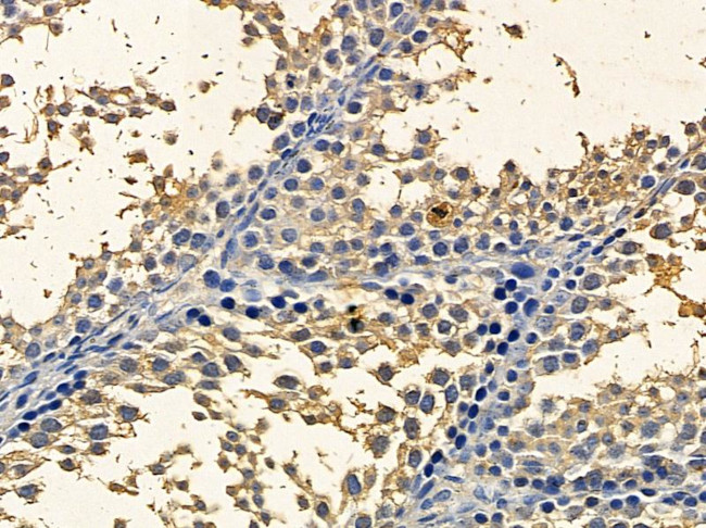 PEX3 Antibody in Immunohistochemistry (Paraffin) (IHC (P))