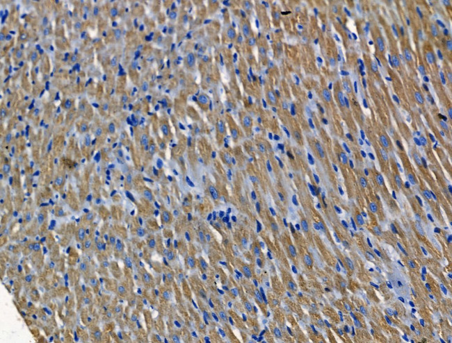 PGAM2 Antibody in Immunohistochemistry (Paraffin) (IHC (P))