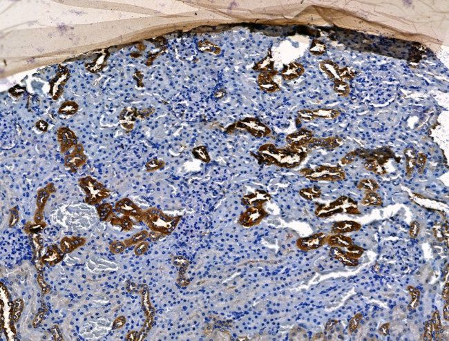 PGAM2 Antibody in Immunohistochemistry (Paraffin) (IHC (P))