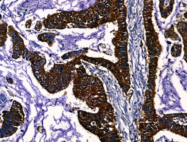 PGAM2 Antibody in Immunohistochemistry (Paraffin) (IHC (P))