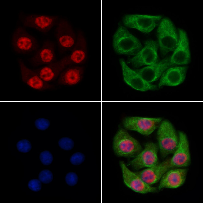 PHF8 Antibody in Immunocytochemistry (ICC/IF)