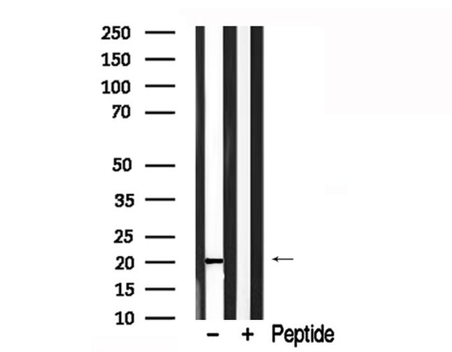 Phospholamban Antibody in Western Blot (WB)