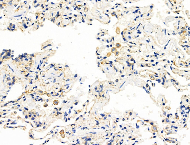 CALM Antibody in Immunohistochemistry (Paraffin) (IHC (P))