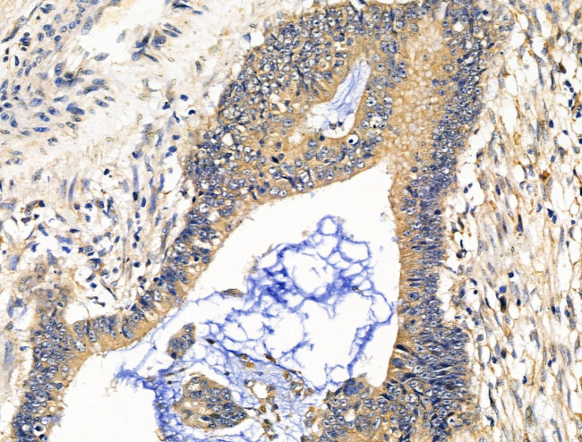 CALM Antibody in Immunohistochemistry (Paraffin) (IHC (P))