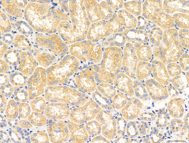 CALM Antibody in Immunohistochemistry (Paraffin) (IHC (P))