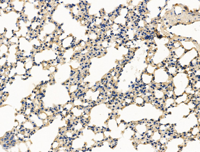 CALM Antibody in Immunohistochemistry (Paraffin) (IHC (P))