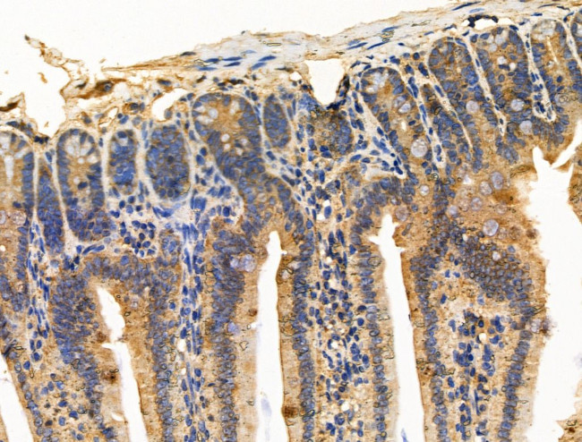 CALM Antibody in Immunohistochemistry (Paraffin) (IHC (P))