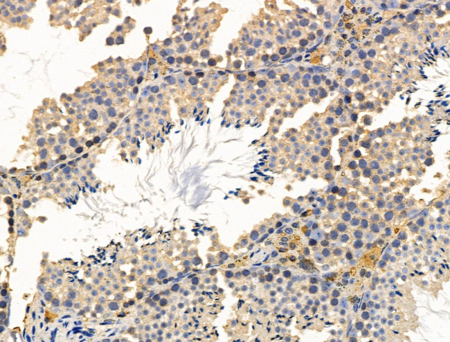 CALM Antibody in Immunohistochemistry (Paraffin) (IHC (P))