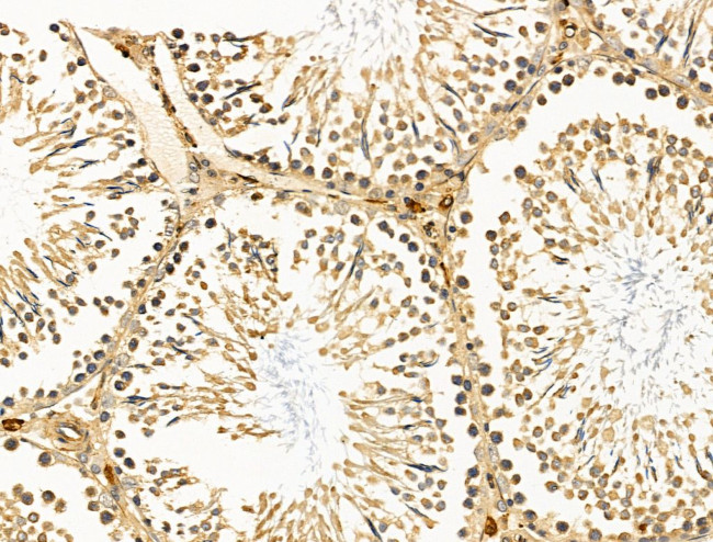 CALM Antibody in Immunohistochemistry (Paraffin) (IHC (P))