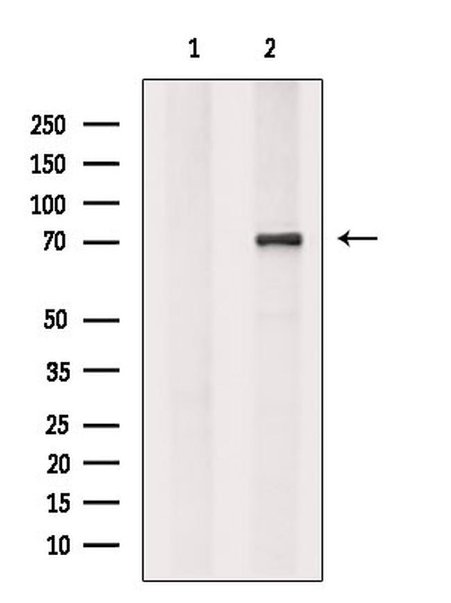 CALM Antibody in Western Blot (WB)