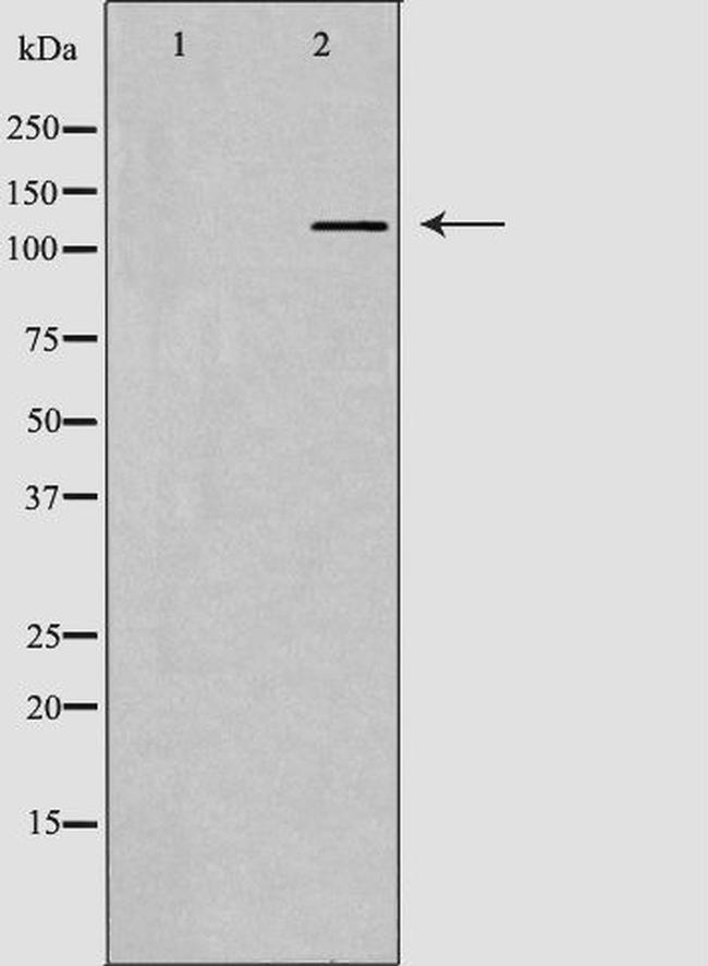 PIK3CB Antibody in Western Blot (WB)