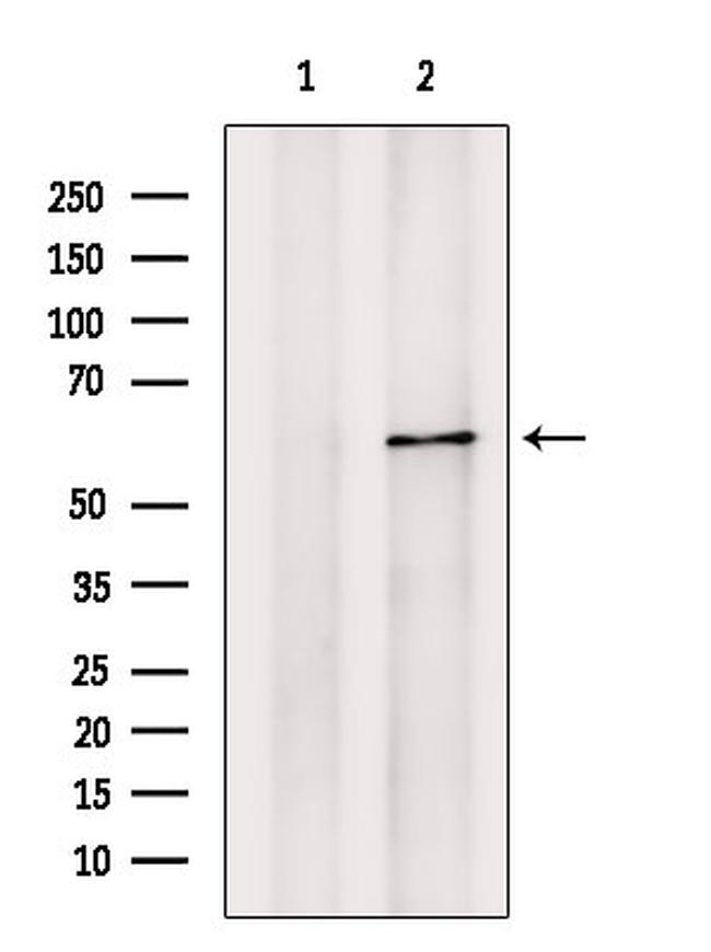 PIP5K1B Antibody in Western Blot (WB)