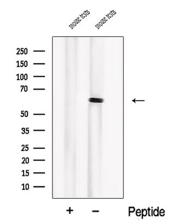 PIP5K1B Antibody in Western Blot (WB)