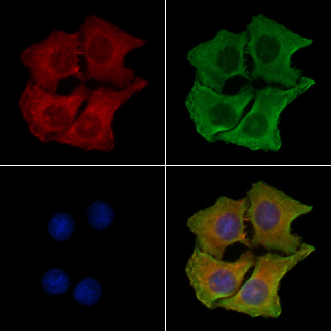 PIP5K1C Antibody in Immunocytochemistry (ICC/IF)