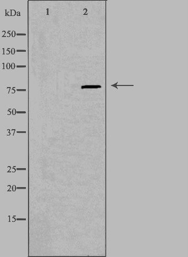 PIP5K1C Antibody in Western Blot (WB)