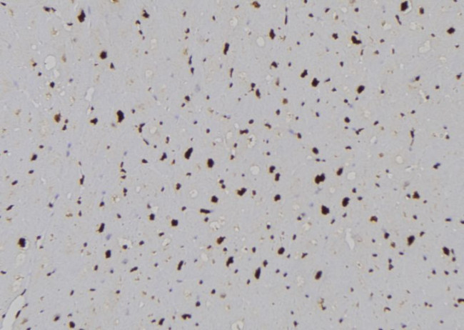 PLCB1 Antibody in Immunohistochemistry (Paraffin) (IHC (P))