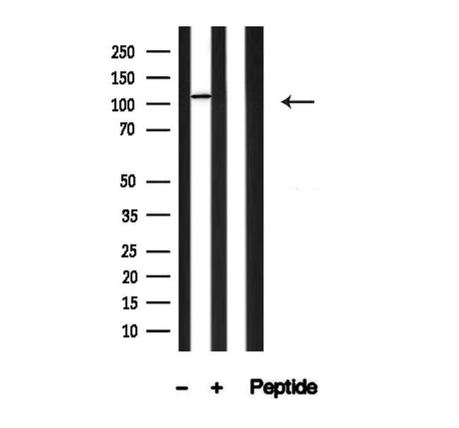 PLD1 Antibody in Western Blot (WB)