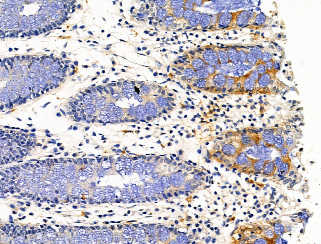 PLXNA4 Antibody in Immunohistochemistry (Paraffin) (IHC (P))