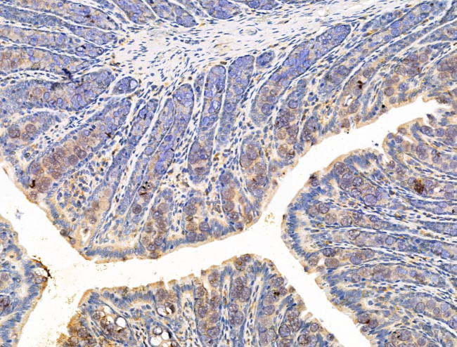 PLXNA4 Antibody in Immunohistochemistry (Paraffin) (IHC (P))