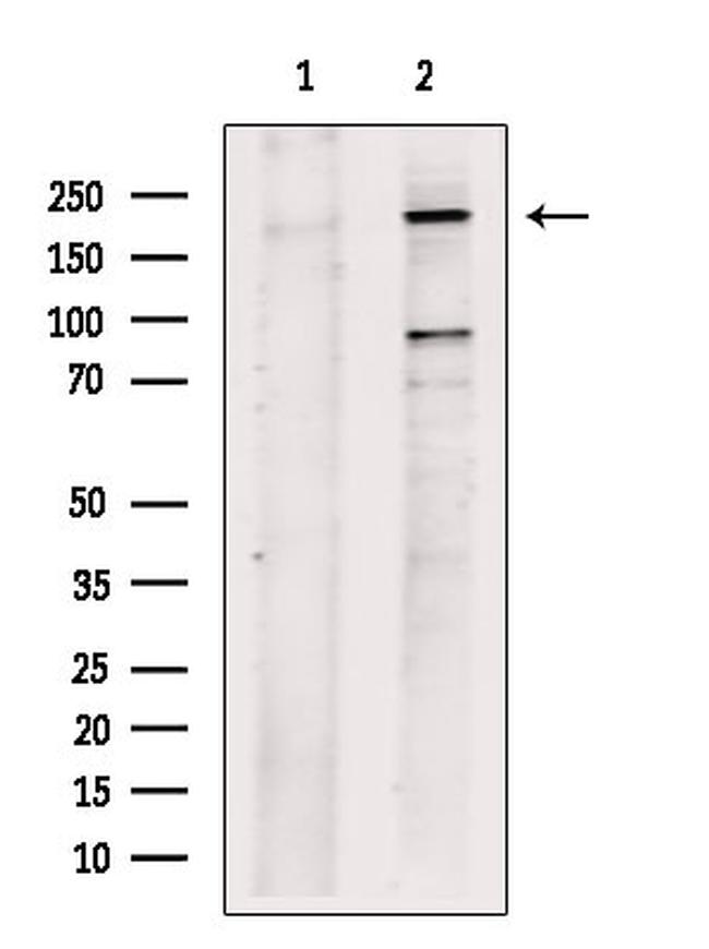 PLXND1 Antibody in Western Blot (WB)