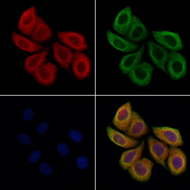 PLVAP Antibody in Immunocytochemistry (ICC/IF)