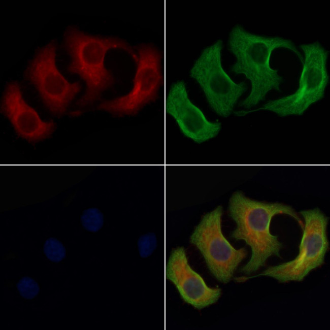 PNP Antibody in Immunocytochemistry (ICC/IF)