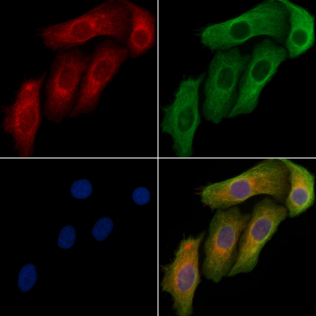 PNPase Antibody in Immunocytochemistry (ICC/IF)