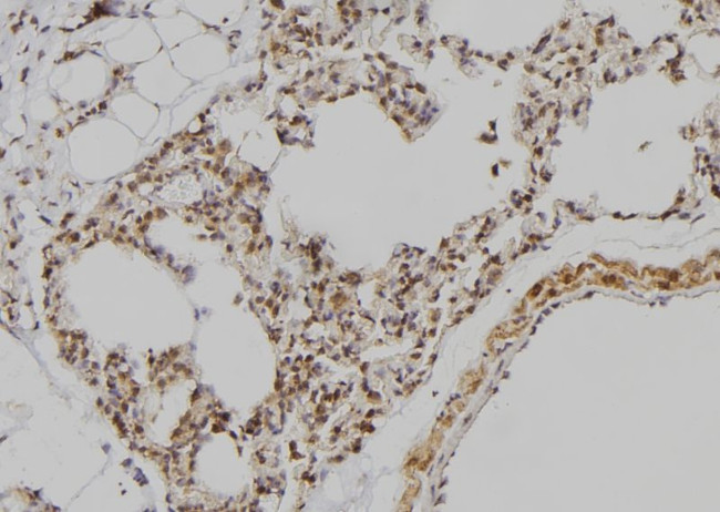 POU3F3 Antibody in Immunohistochemistry (Paraffin) (IHC (P))