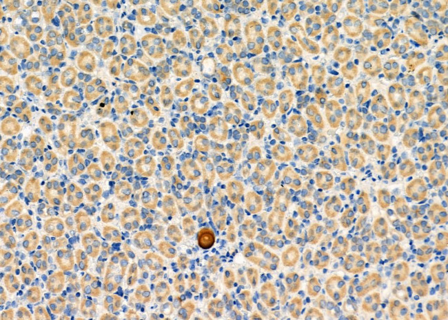 PPA1 Antibody in Immunohistochemistry (Paraffin) (IHC (P))